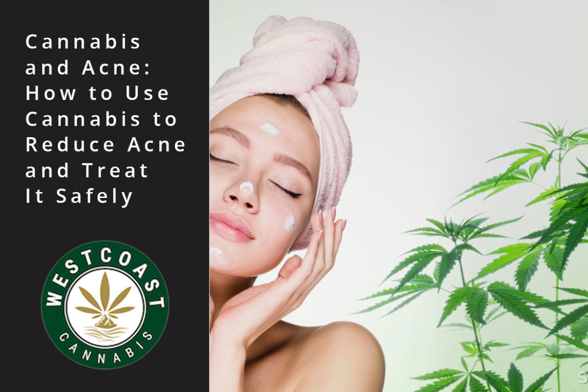 wcc blog cannabis for acne
